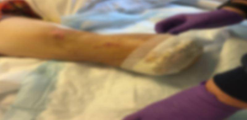 شراب کے نشے میں دھت شخص بھوک لگنے پر محبوبہ کی ٹانگیں کاٹ کر کھا گیا