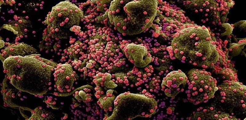 کرونا وائرس سطحوں یا اشیا کو چھونے سے آسانی سے نہیں پھیلتا، امریکی سینٹر فار ڈیزیز کنٹرول اینڈ پریوینشن کی نئی ہدایات جاری