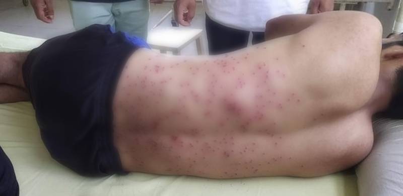 مقبوضہ کشمیر میں محرم کے جلوس پر پیلٹ گنز سے حملہ، درجنوں شیعہ نوجوان زخمی