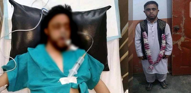 گردے نکالنے کی کہانی جھوٹی نکلی، نوجوان روڈ حادثے میں زخمی ہوا: ڈاؤن سنڈروم سے متاثر نوجوان زیر علاج