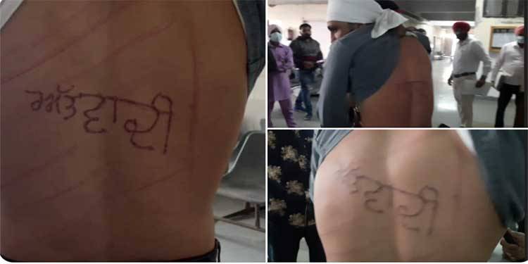 انڈیا میں قیدی کے جسم پر گرم سلاخ سے 'آتنک وادی' لکھ دیا گیا